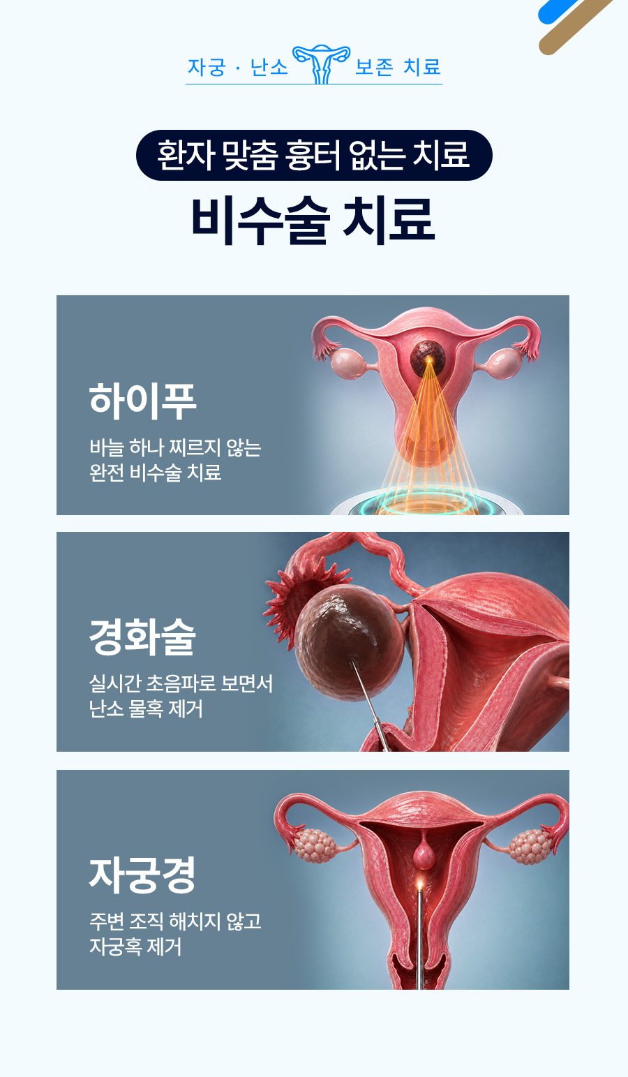 자궁근종